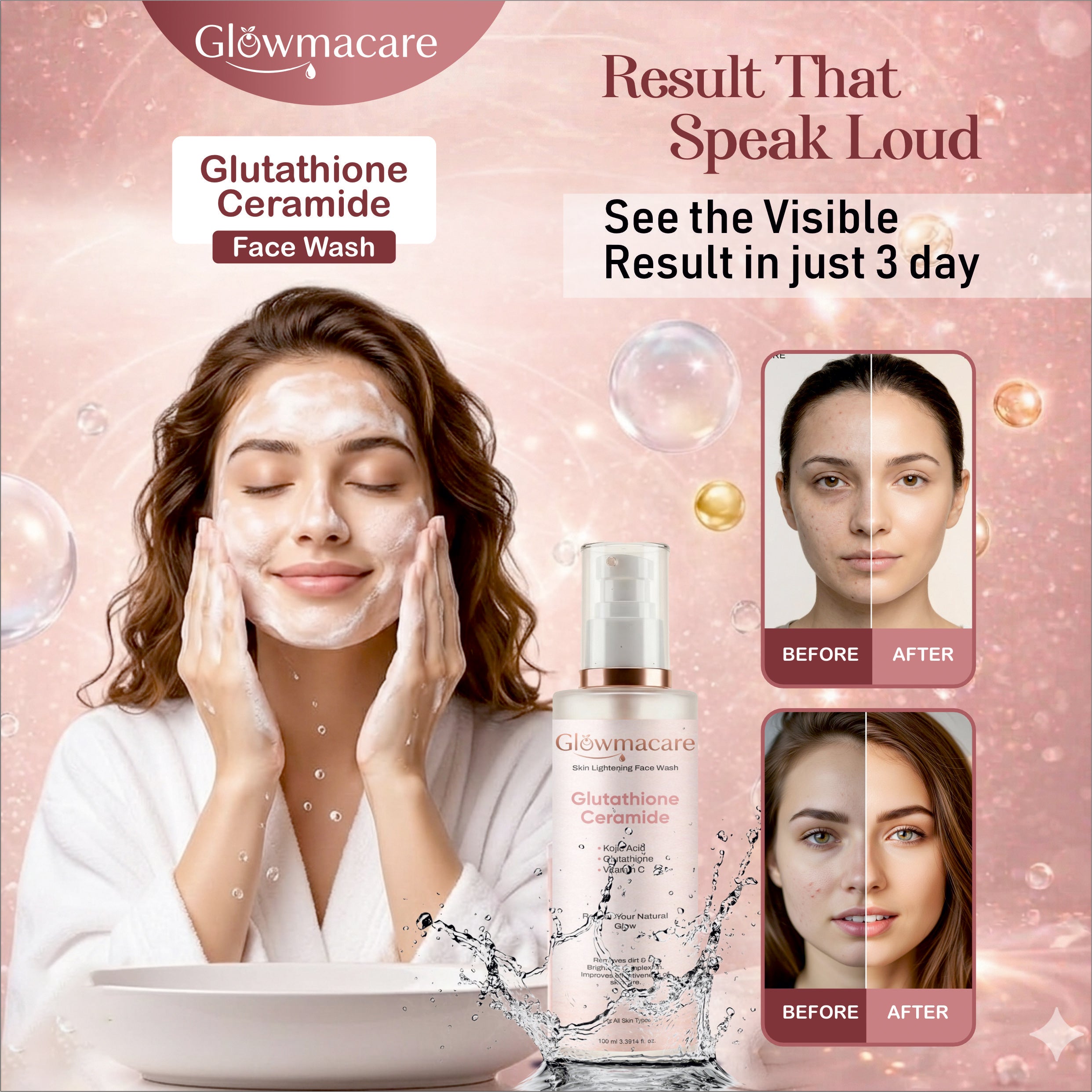 GlowmaCare Acne Clear Gel